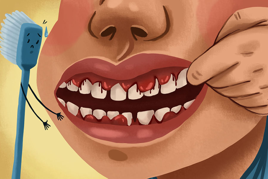 Cartoon showing a patient with bleeding gums due to gum disease.