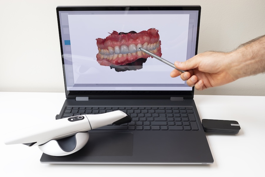 3d scanner for digital dentistry and digital impressions